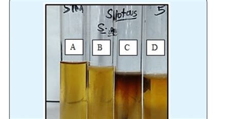 Pseudomonas Aeruginosa: Characteristics and Oxidase Test .